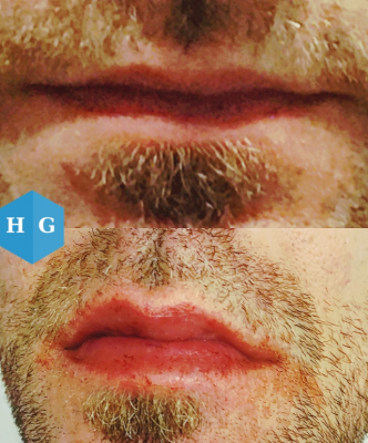 Foto Gonz�lezEst�ticaFacial (Centro Est�tico 2020)